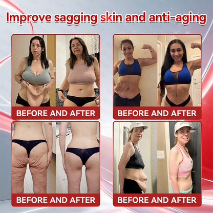 𝑶𝒇𝒇𝒊𝒄𝒊𝒂𝒍 𝑺𝒕𝒐𝒓𝒆 | LBMLBM™ 𝑮𝐋𝗣-𝟭 + 𝑪𝒐𝒍𝒍𝙖𝙜𝙚𝙣 𝐏𝐞𝐩𝒕𝒊𝒅𝒆𝒔 𝑾𝒆𝒊𝗴𝗵𝘁 𝐋𝐨𝐬𝐬 & 𝑭𝒊𝒓𝒎𝙞𝙣𝙜 𝑶𝒓𝒂𝐥 𝑺𝒐𝐥𝒖𝒕𝒊𝒐𝒏 💎 𝗼𝗯𝗲𝘀𝗶𝘁𝘆, 𝗳𝗶𝗿𝗺𝘀 𝘀𝗸𝗶𝗻, 𝗰𝗮𝗿𝗱𝗶𝗼𝘃𝗮𝘀𝗰𝘂𝗹𝗮𝗿 𝗱𝗶𝘀𝗲𝗮𝘀𝗲, 𝗱𝗶𝗮𝗯𝗲𝘁𝗲𝘀, 𝘀𝗹𝗲𝗲𝗽 𝗮𝗽𝗻𝗲𝗮, 𝗷𝗼𝗶𝗻𝘁 𝗽𝗿𝗼𝗯𝗹𝗲𝗺𝘀, 𝗮𝗻𝗱 𝗺𝗼𝗿𝗲💎