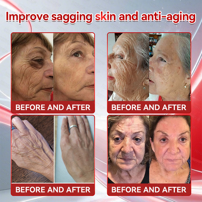 𝑶𝒇𝒇𝒊𝒄𝒊𝒂𝒍 𝑺𝒕𝒐𝒓𝒆 | LBMLBM™ 𝑮𝐋𝗣-𝟭 + 𝑪𝒐𝒍𝒍𝙖𝙜𝙚𝙣 𝐏𝐞𝐩𝒕𝒊𝒅𝒆𝒔 𝑾𝒆𝒊𝗴𝗵𝘁 𝐋𝐨𝐬𝐬 & 𝑭𝒊𝒓𝒎𝙞𝙣𝙜 𝑶𝒓𝒂𝐥 𝑺𝒐𝐥𝒖𝒕𝒊𝒐𝒏 💎 𝗼𝗯𝗲𝘀𝗶𝘁𝘆, 𝗳𝗶𝗿𝗺𝘀 𝘀𝗸𝗶𝗻, 𝗰𝗮𝗿𝗱𝗶𝗼𝘃𝗮𝘀𝗰𝘂𝗹𝗮𝗿 𝗱𝗶𝘀𝗲𝗮𝘀𝗲, 𝗱𝗶𝗮𝗯𝗲𝘁𝗲𝘀, 𝘀𝗹𝗲𝗲𝗽 𝗮𝗽𝗻𝗲𝗮, 𝗷𝗼𝗶𝗻𝘁 𝗽𝗿𝗼𝗯𝗹𝗲𝗺𝘀, 𝗮𝗻𝗱 𝗺𝗼𝗿𝗲💎