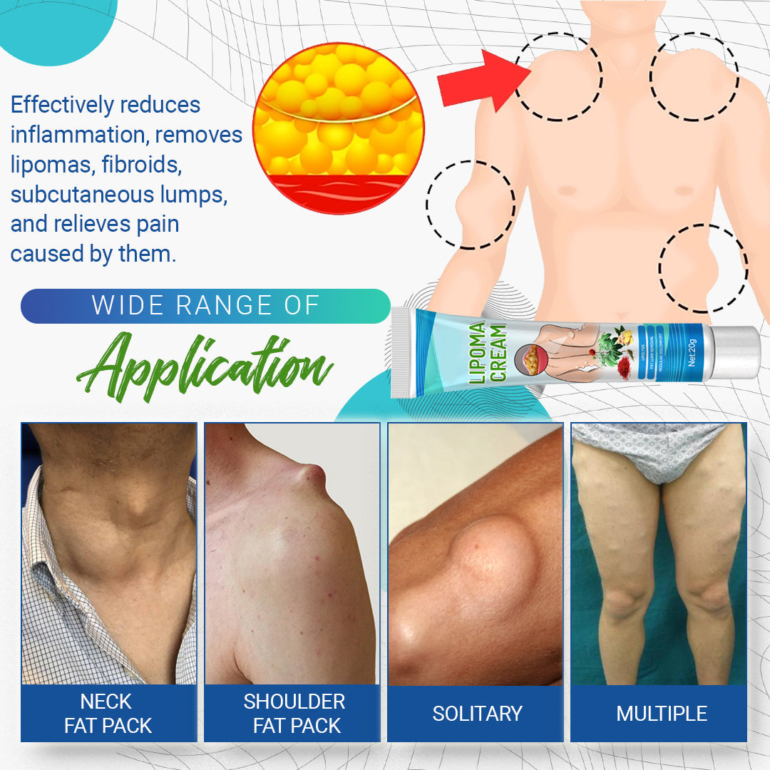 LumpFree™ Lipoma Removal Cream