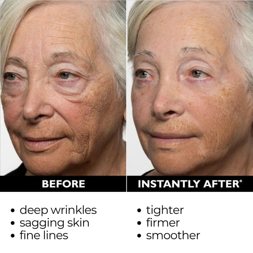 Final 3 Hours: 80%OFF🔥Instant Temporary Face Tightener