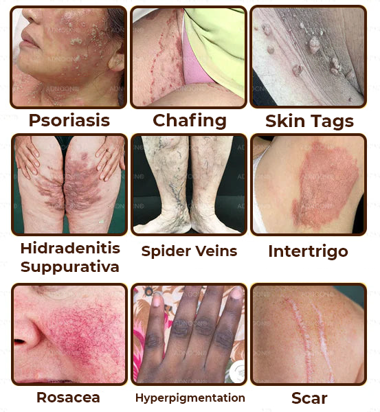 Zakdavi™ Emu Oil - Full Body Repair Cream