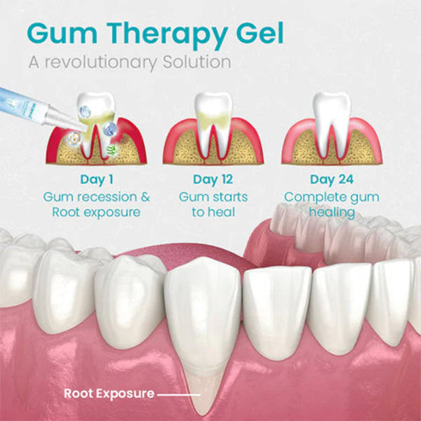 🔥Last Day 69% OFF-SEURICO™ Gum Shield Therapy Gel