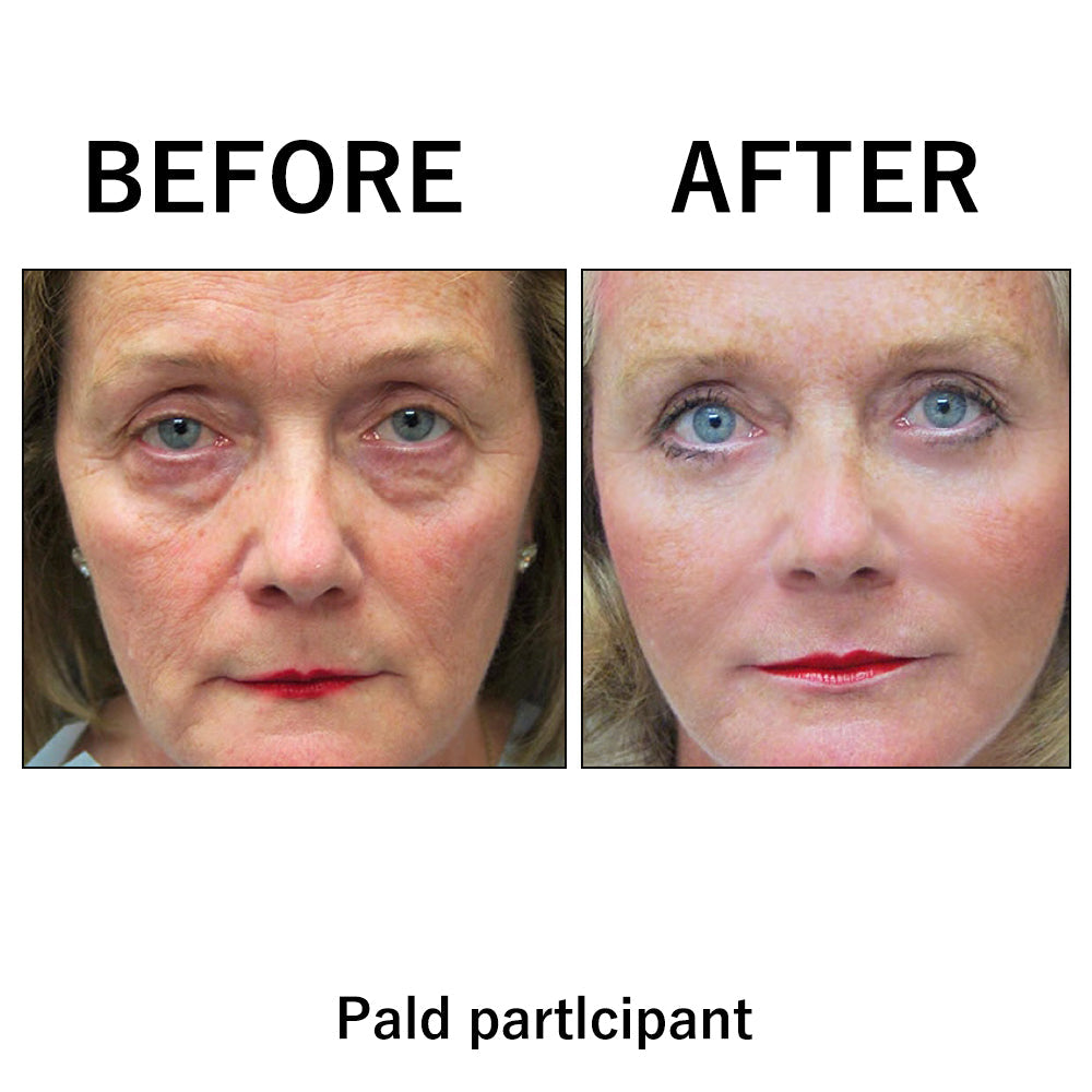 Final 3 Hours: 80%OFF🔥Instant Temporary Face Tightener