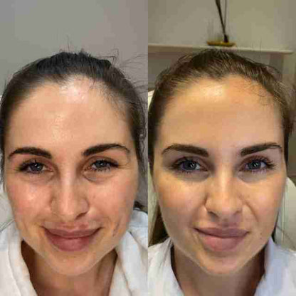 Seurico™™ Power Redo Anti-Aging Blur & Smooth Wrinkle Filler-Last Day Sale 90% OFF 🔥Buy 1 Get 2 Free🔥