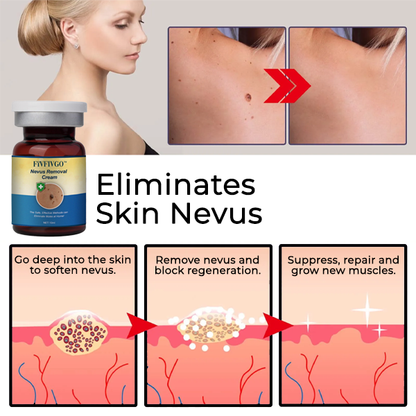 Seurico™ Nevus Removal Cream