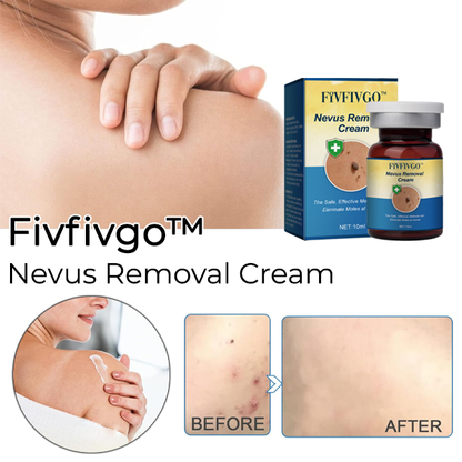 Seurico™ Nevus Removal Cream