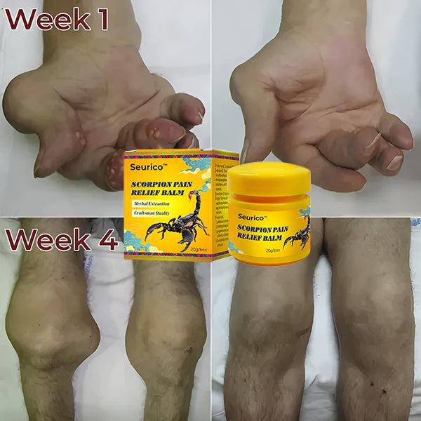 🦂 Seurico™ Schmerzlinderungscreme mit Skorpiongift