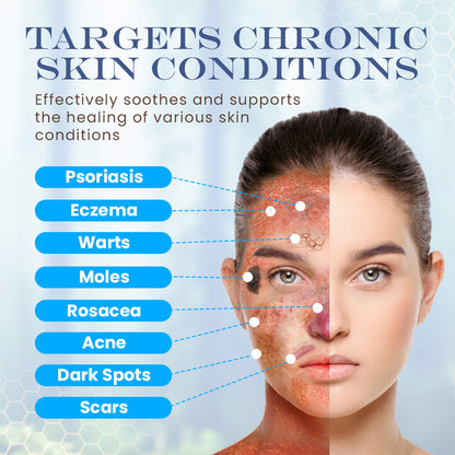 Seurico™ Snail Mucin Skin Treatment Cream (AAD Recommended👨‍⚕️)💖💟